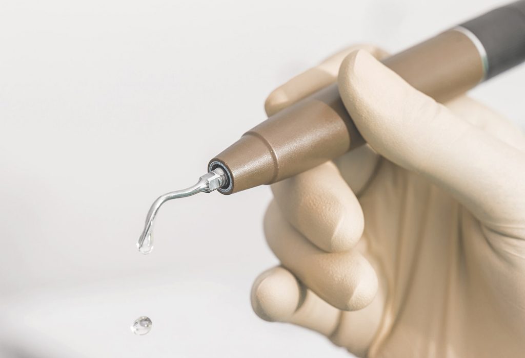 limpieza dental profesional